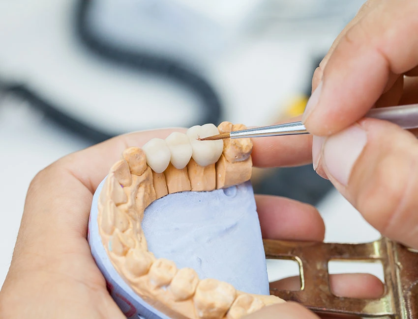 Dental Bridge in Canyon Country, CA