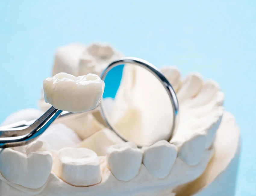 Dental Crowns in Canyon Country, CA