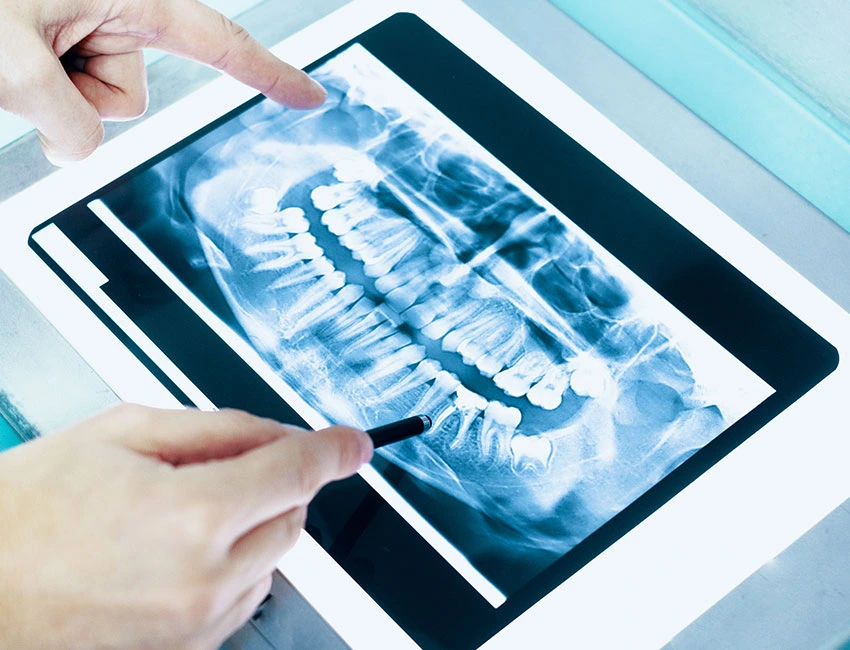 General Dentistry at Canyon Country Dental Care
