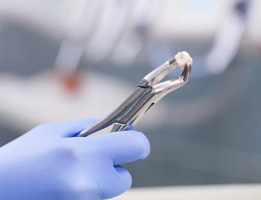 Oral Surgery at Canyon Country Dental Care
