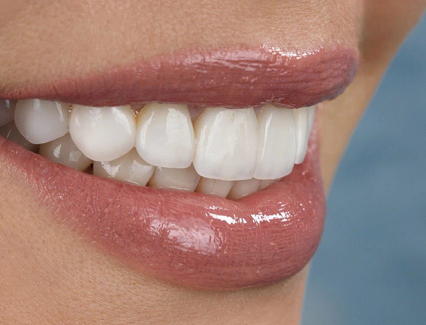 Cosmetic Dentistry at Canyon Country Dental Care