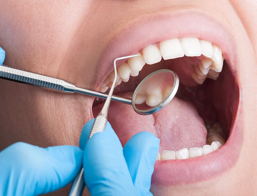 Signs you may need dental cleaning — Canyon Country Dental Care