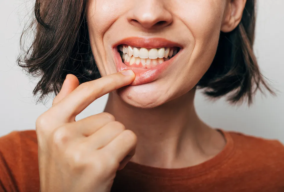 Dental Abscesses
