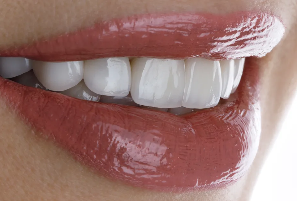 Patient with perfect teeth